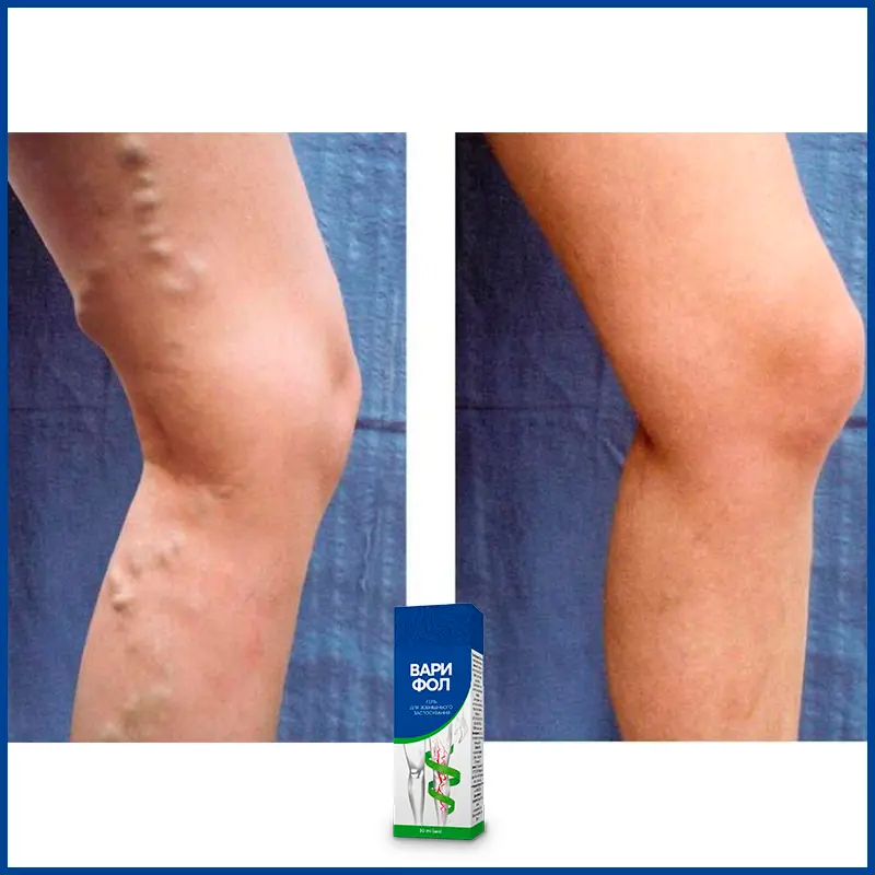 Варифол відгук 5